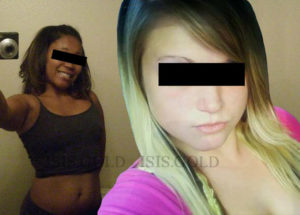 HYDROQUINONE 30% CREAM photo review
