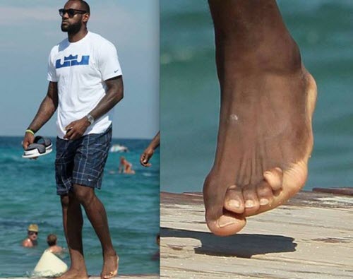 fix ugly feet, repair ugly feet