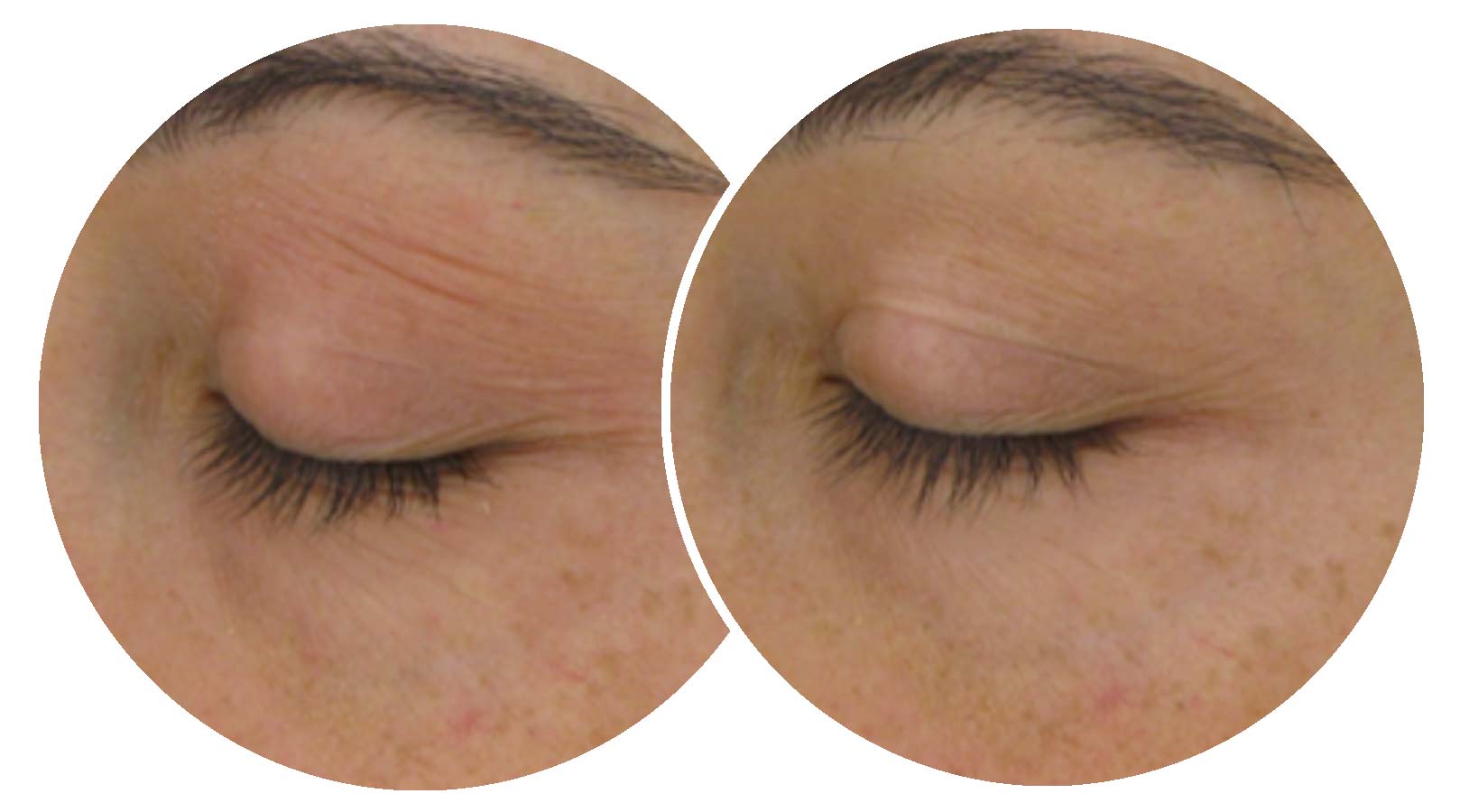 OptiMSM Anti-Aging Results