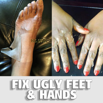 FIX UGLY FEET & HANDS