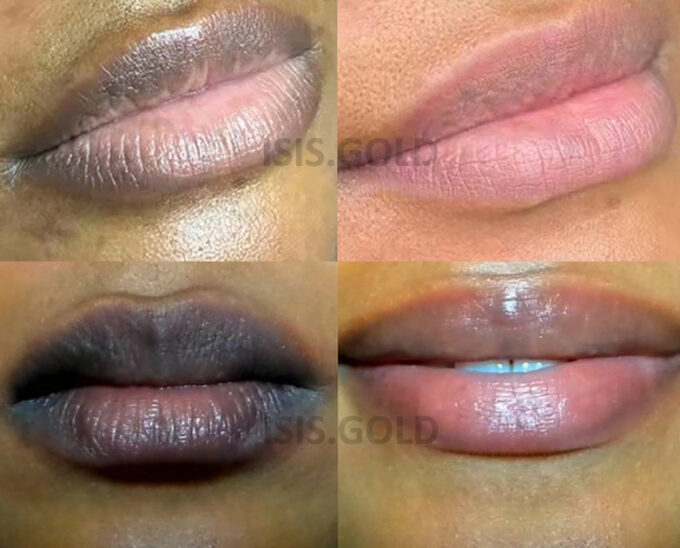 LIP BLEACHING LIP BALM