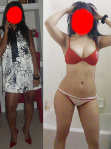HYDROQUINONE 30% CREAM photo review